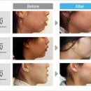 치아나라치과교정과치과의원 이미지