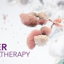 새로운 항암제 등장 (면역항암요법, Cancer immunotherapy) 이미지