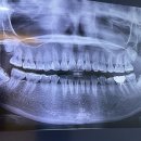 이천바로치과의원 이미지