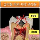 명동치과기공소 이미지