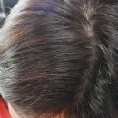 람가헌 | [ 잎순 ] 지루성 두피염 샴푸 , 2주간의 리얼 사용 후기