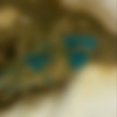 수원구치소부속의원 | 물풍선 삼킴사고/ 용인세브란스 소아응급실 방문후기/ 증상별 응급실 추천어플 응급똑똑/3일차 대변배출