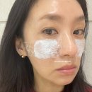 피어봄의원 | 강남역 피부과 앞볼 꺼짐 주베룩 볼륨 시술 솔직후기 통증 다운타임 가격정보