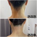 라밍왁싱 | 대전 임산부 왁싱 천연 왁스 사용 저자극 라밍왁싱