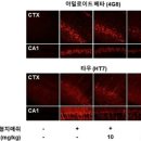 &#34;브로콜리 성분, 치매 유발 독성 단백질 제거 효과&#34; 이미지