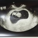 로얄사임당산후조리원 이미지