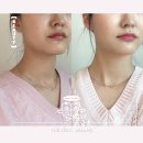 일산 정발산 팔자주름 볼링크(볼뉴머+슈링크유니버스) 찐 후기