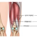 타이트짐 이미지