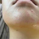 월경과 혼재 이미지