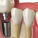 동구이편한치과의원 이미지