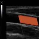 하나초음파테크 이미지