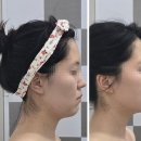 순에스테틱 피부미용 | 부산대에스테틱 피부관리 전문 뷰티인스킨 입체윤곽관리 후기