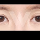 원더풀성형외과의원 이미지