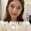 그린e치과기공소 | 청주 금천동 피부관리 &#39;미녀를 그리다&#39; 온다리프팅+케라손 미친 효과 후기
