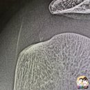 성북본튼튼의원 이미지