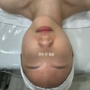 숨앤쉼에스테틱 | [목동피부관리] 웨딩관리로 추천! 숨앤쉼에스테틱 작은얼굴관리 후기