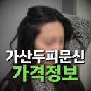 천왕헤어 영등포점 | 가산두피문신, 가격 비교 중이라면?
