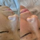 행신초등학교 | 일산행신피부관리 꿀벌스킨앤바디 수분케어 후기｜각질·속건조 피부 케어 제대로