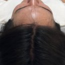 일러스라인 이미지