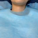 서면한의원 | 부산 흉터치료 서면 피부한의원 새살침 4회차 후기