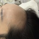 새로이헤어 | 동탄탈모관리 두피관리 새로이채움