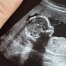 하이베베 이미지