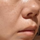 40대 코 블랙헤드, 엑스트라 슈퍼9 플러스 액티브 스틱 후기