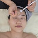 동탄기흥로257번가길 | [동탄 에스테틱] 여라뷰티 x 리라신 애씨큘 필링 ; 단 1회 만으로 탕후루피부 만들기