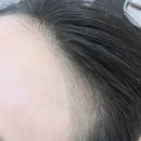 김헤어라인 이미지