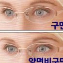 아이셀렉트안경 이미지