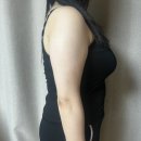 신사라라약국 | 상상만 했던 팔뚝 지방 정리💪 믿고 방문한 의원에서 지방분해주사 1회차 생생 후기!