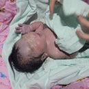 더블유여성병원 이미지