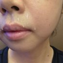 [마운자로 1~2일차 후기] 2.5mg 시작계기와 첫날 부작용 &amp; 체중변화