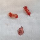 [쓰담쓰담동물병원] 30kg이 넘는, 신장이 약한 멍멍이의 치과치료
