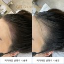 황산제 | 당당한 이마 헤어라인 문신으로