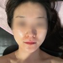 [뽈뽈리뷰] 뷰티블라썸 연산동에스테틱 작은얼굴관리 후기 / 웨딩관리추천
