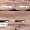 피부를 말하다 이미지