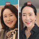 거상미디어 | 윤영미 64세 안면거상, 티 나나 봤더니 "50대에 할 걸" 후회한 이유