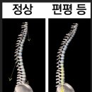 허리아플때 스트레칭 효과본 방법 시원허리 편평등 교정기 내돈내산