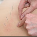 일침한의원 이미지