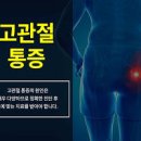 고관절 통증 원인 증상 이미지