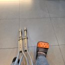 연세더바로병원 | 우측 제5중족골 기저부 골절_수술 후기 1 (at 가자연세병원)