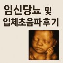 임당지구1 | 임신 26주차 임당검사 및 입체초음파 후기