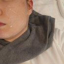 울트라상가 | 아산피부관리 가람뷰티 울트라하이푸 리프팅 후기