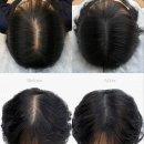 마음에점을찍다 이미지