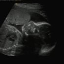 부강정밀 이미지