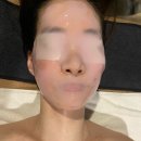 가비에스테틱 | 강남에스테틱 뷰티블르바드 포함 내돈내산 본식전 관리 추천 / 보톡스, 치아미백제 등