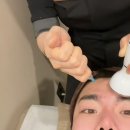 셀더영의원 | 언주역피부과 추천 포텐자엑소좀, 디자인튠페이스 시술 후기 (멍, 붓기)
