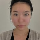 GS25 논현청능점 | 신논현 캐롤뷰티 | 시그니처 윤곽관리 받고 얼굴 비대칭 개선 찐후기