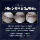 김포정형외과 아픈무릎 사용 자제해야되요 이미지